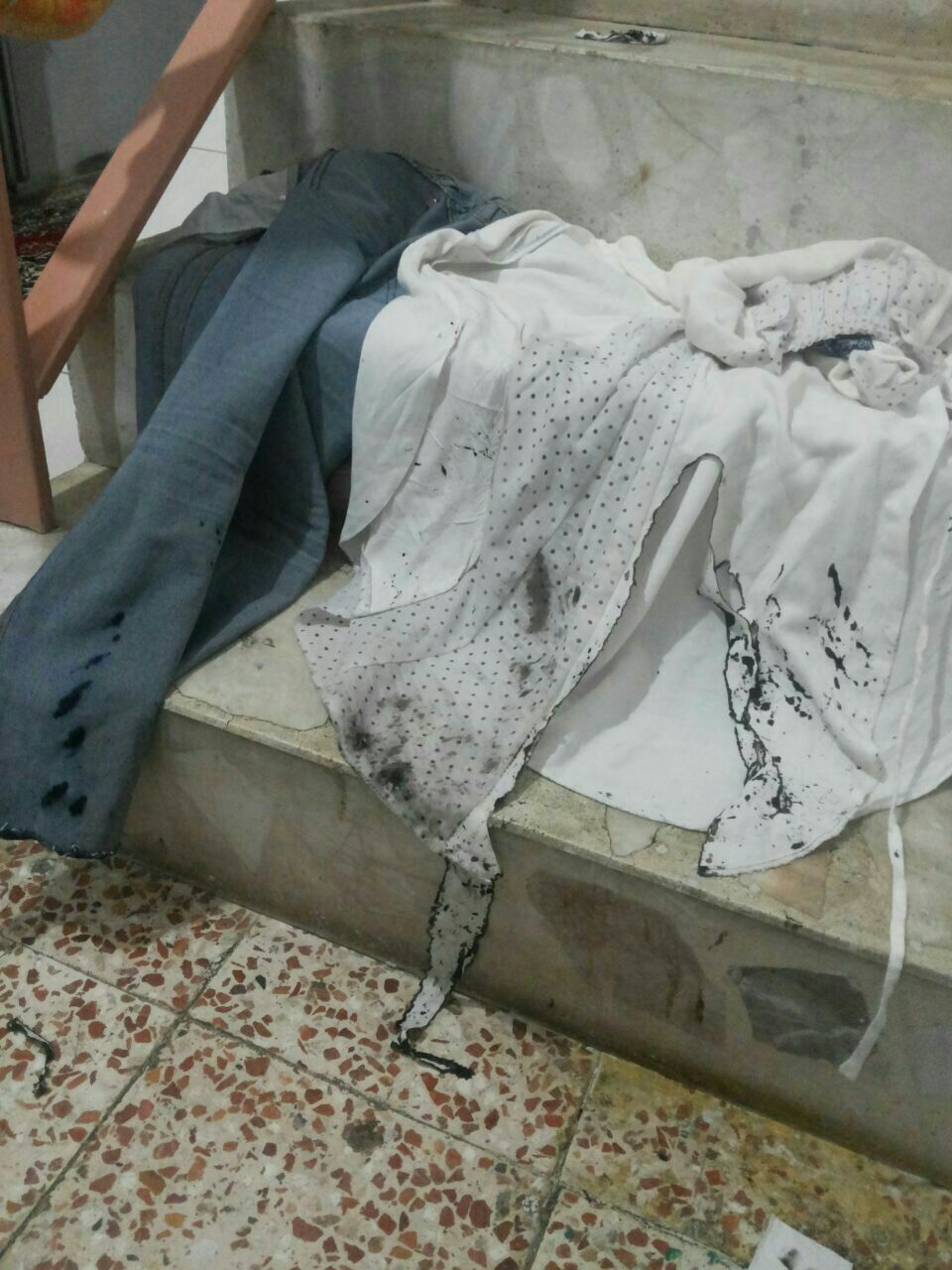 تناقضات مسئولین رژیم در اعلام انگیزه اسید پاشی به چند زن در بوکان