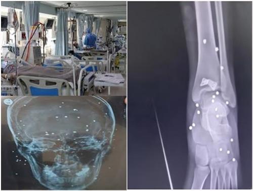 گزارشی دردناک و تکان دهنده از جنایت علیه بشریت توسط حکومت اسلامی در بیمارستان های ایران